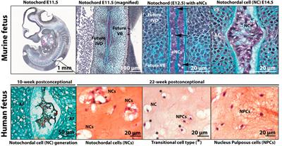 Notochordal Cell-Based Treatment Strategies and Their Potential in Intervertebral Disc Regeneration